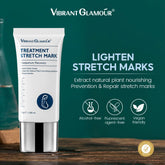 Vibrant Glamour Stretch Marks Remover Cream - 30g